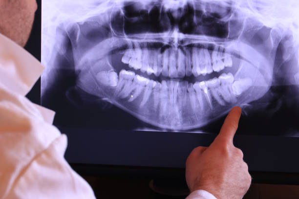 Best Emergency Dentist for Knocked-Out Tooth in Wilson, NC